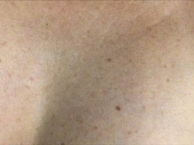 Yayın ekran görüntüleri Alianakiss